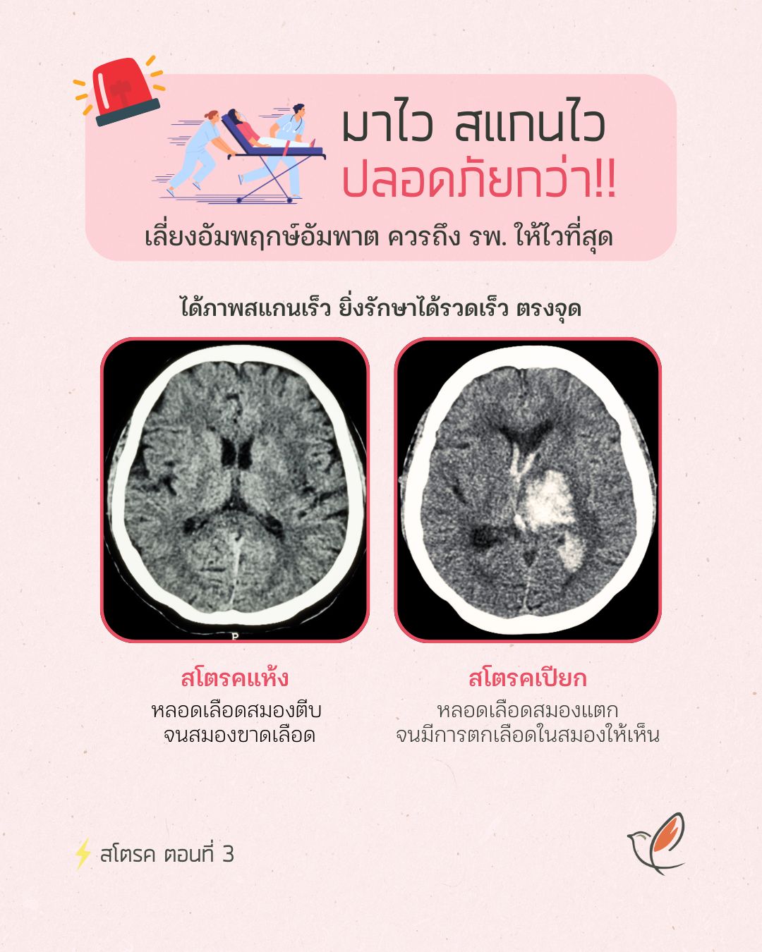 stroke 03 fast track ct scan neurological psychiatric sleep health cheery chirpy wellcheck